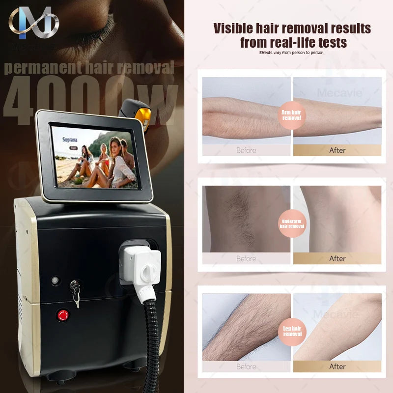 Professional Diode Ice Titanium Laser Hair Removal Machine Portable 808 830 755 940 1064 Device 5Waves Permanent Removal